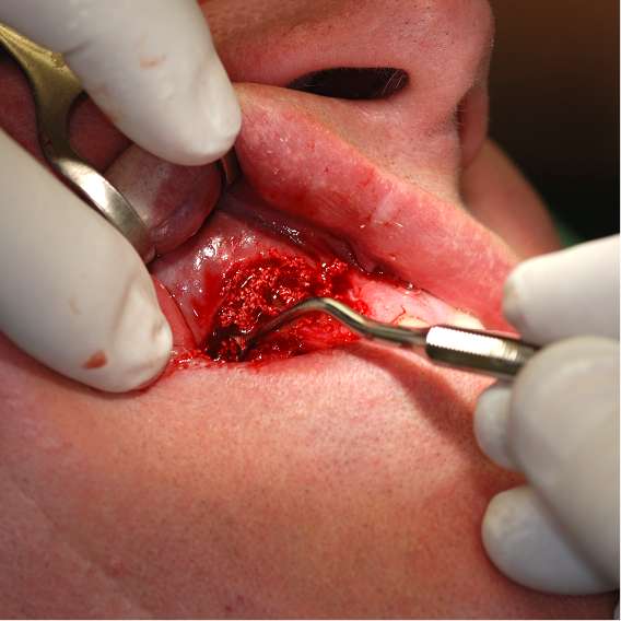 Chirurgie