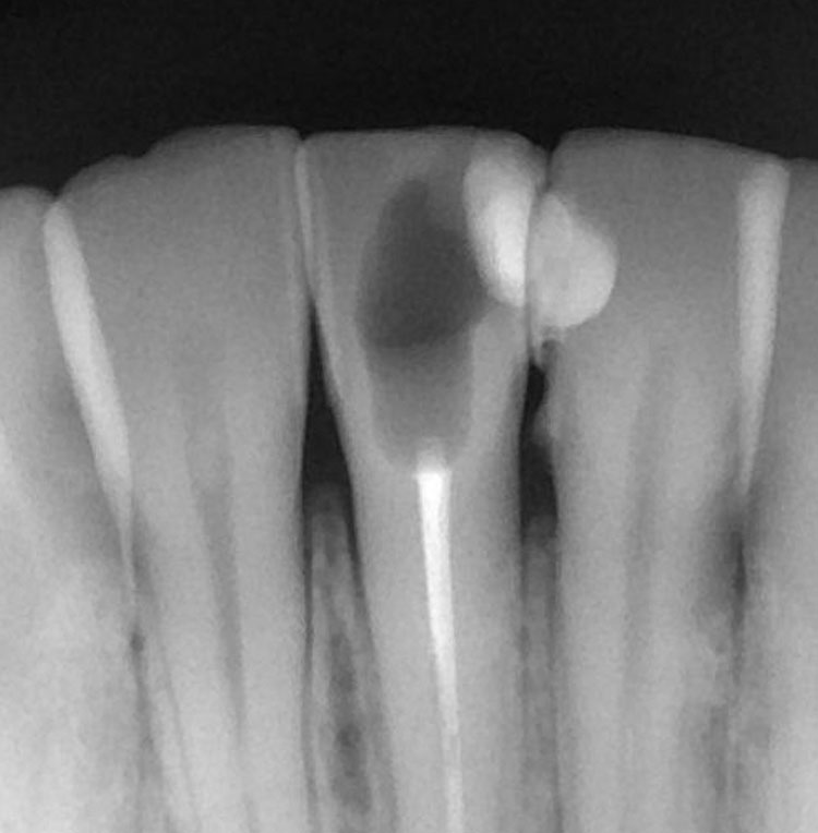 Endodoncie